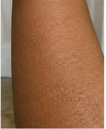 Before using peptide lotion