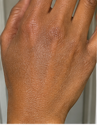 Before using peptide lotion