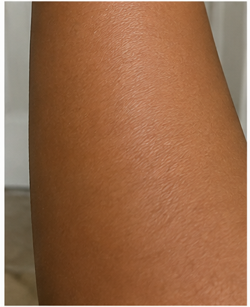 After using peptide lotion