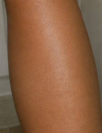 After using peptide lotion