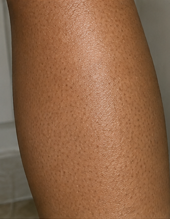 Before using peptide lotion