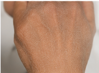 Before using peptide lotion