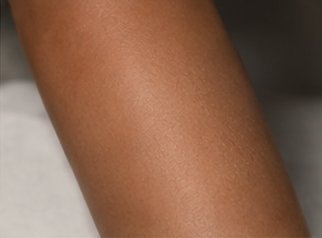 After using peptide lotion