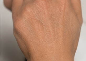 After using peptide lotion