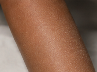 Before using peptide lotion