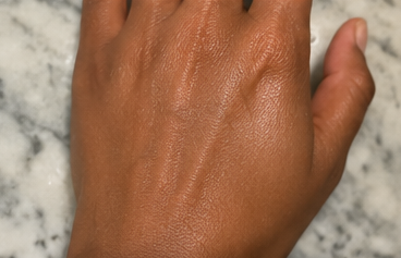 After using peptide lotion