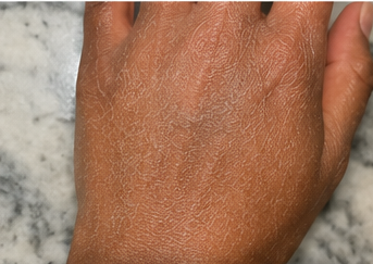 Before using peptide lotion